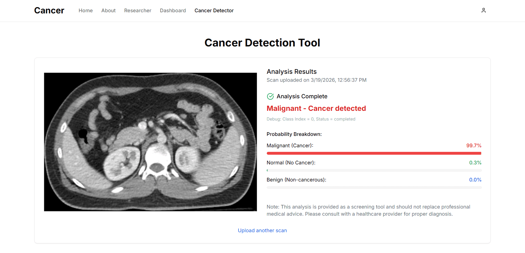 Lung Cancer Detection System